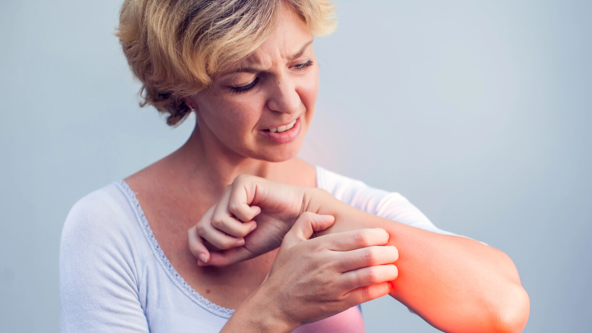 A woman with short blond hair scratches her irritated, red forearm, showing discomfort—an experience often associated with itchy skin during perimenopause or menopause.