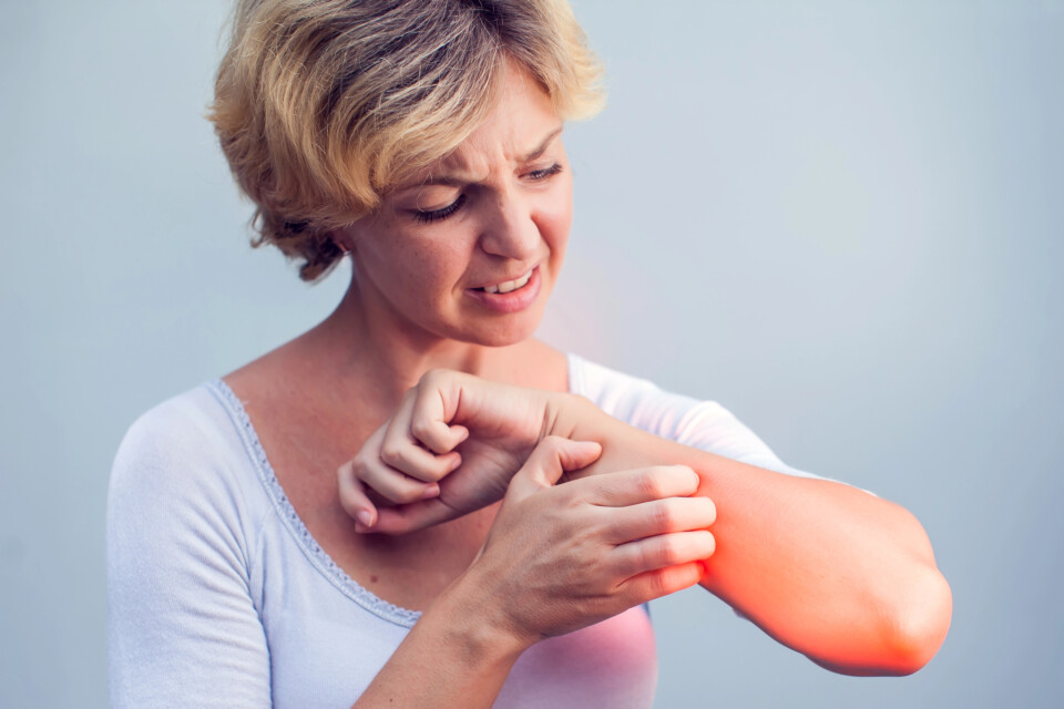 A woman with short blond hair scratches her irritated, red forearm, showing discomfort—an experience often associated with itchy skin during perimenopause or menopause.